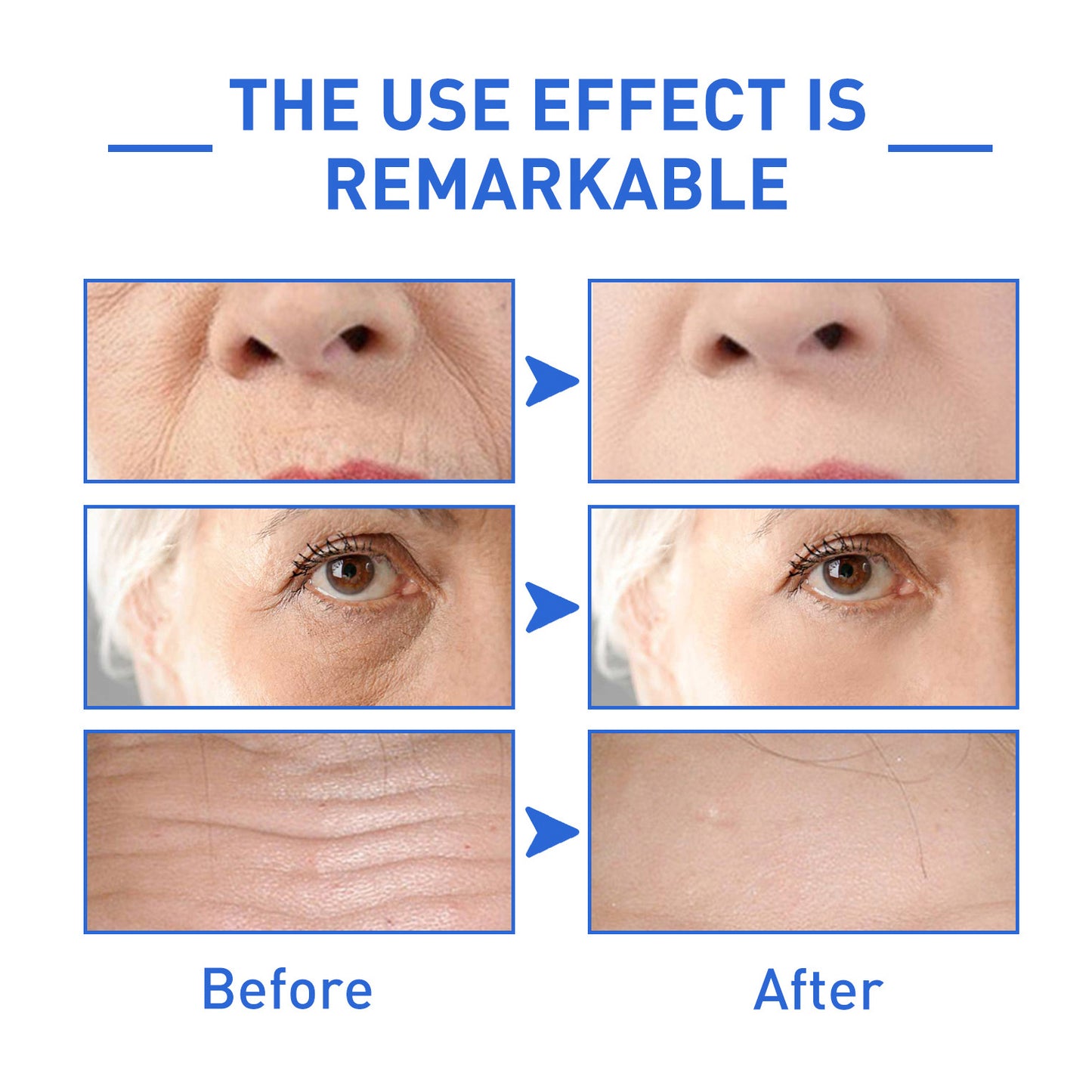 Reveal™--Botox Face Serum