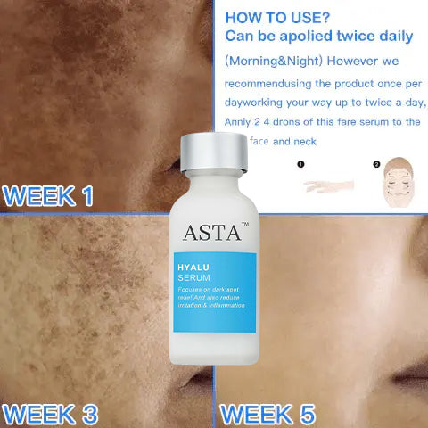 ASTA™ Dark Spot And Acne Treatment lotion