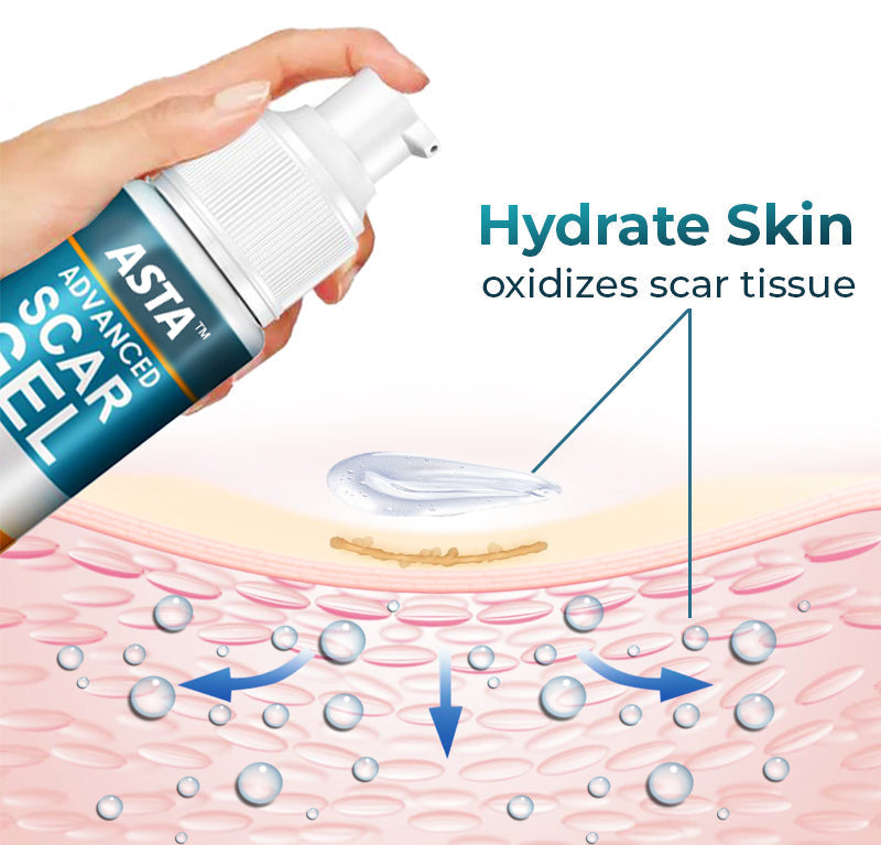 ASTA™ Advanced Scar Removal Gel 🔥
