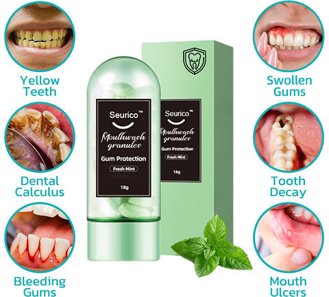 🔥Seurico™ Convenient Gum Protection Pellets (NHS support 👨⚕️)