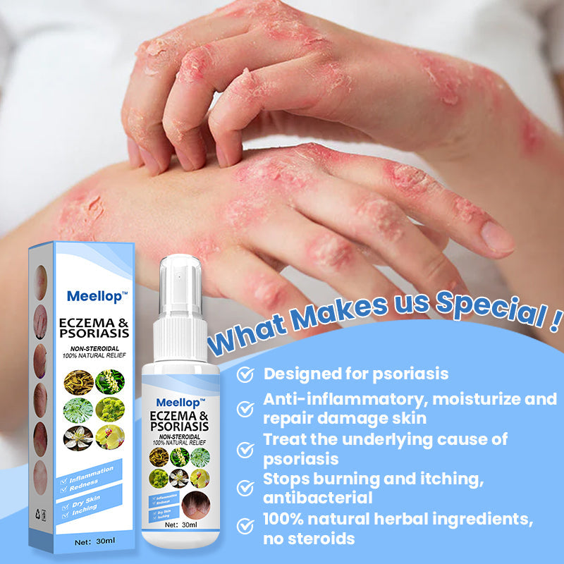 Meellop™ Herbal Psoriasis Relief Spray1