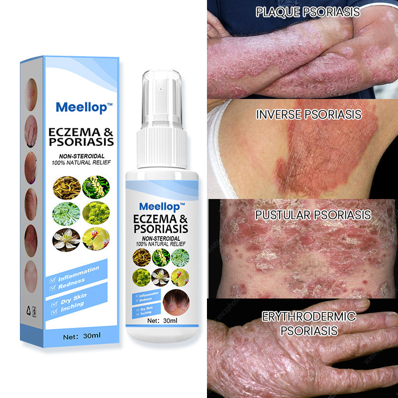 Meellop™ Herbal Psoriasis Relief Spray1