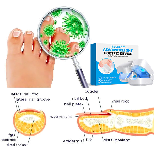 Seurich™ Pure Advance Light FootFix Device