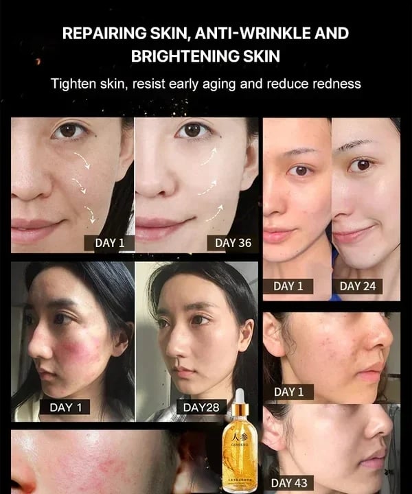 đ„LAST DAY 70% OFFđ„ Ginseng Polypeptide Anti-Ageing Essence