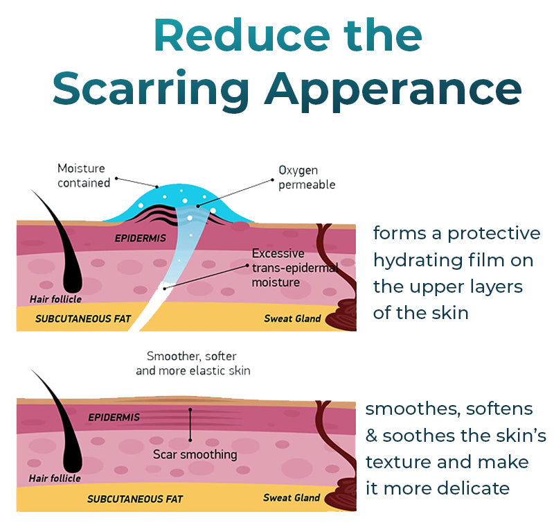 ASTA™ Advanced Scar Removal Gel 🔥