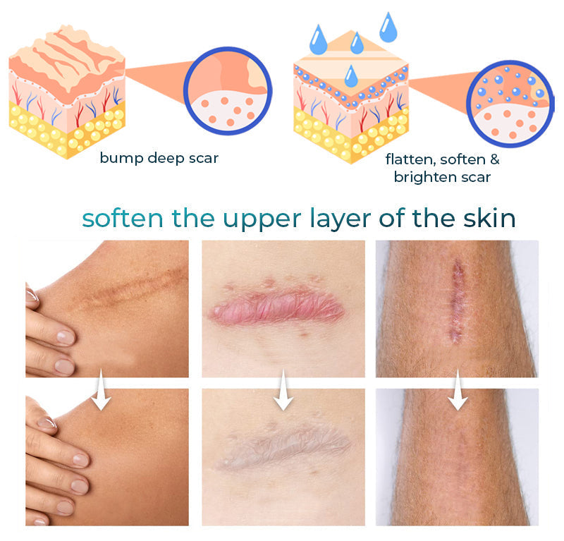 ASTA™ Advanced Scar Removal Gel 🔥