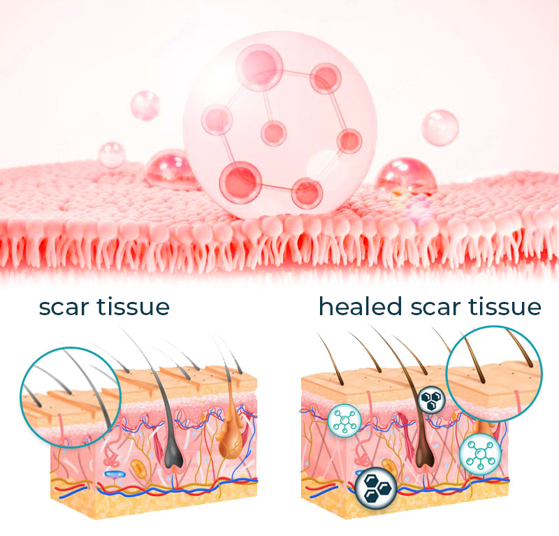 ASTA™ Advanced Scar Removal Gel 🔥