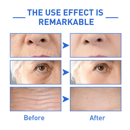 Reveal™--Botox Face Serum