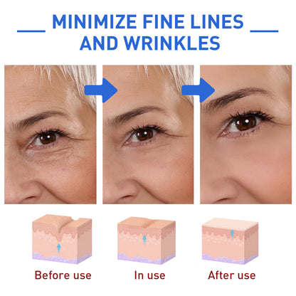 Reveal™--Botox Face Serum