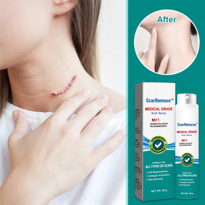 ScarRemove™ Scar and Stretch Mark Refining Spray