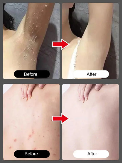 ASTA™-Body Exfoliating Nicotinamide Gel