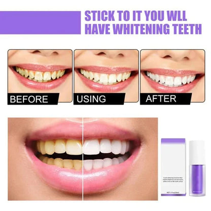 Smilekit™ Deluxe Herbal Teeth Whitening Mousse