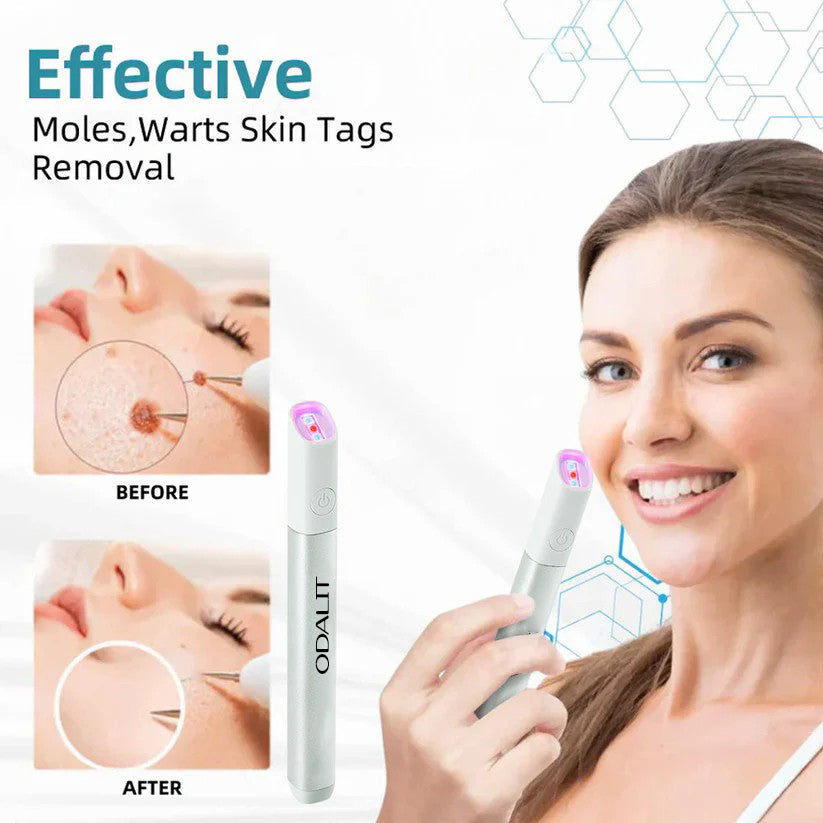 All-in-One CO₂ Laser Eraser Pen | Removes Moles, Warts, Skin Flaws & Pigmentation