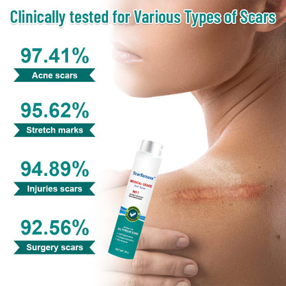 ScarRemove™ Scar and Stretch Mark Refining Spray