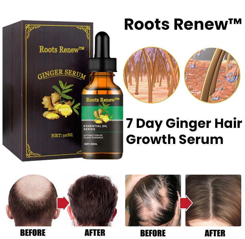 Roots Renew™ Ginger Hair Growth Serum  5% Minoxidil