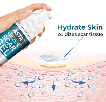 ASTA™ Advanced Scar Removal Gel 🔥