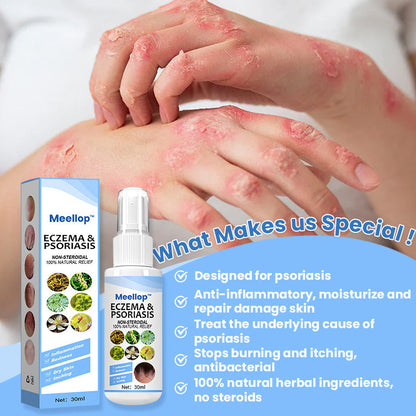 Meellop™ Psoriasis Treatment Spray💖