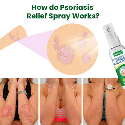 Meellop™ Herbal Psoriasis Relief Spray