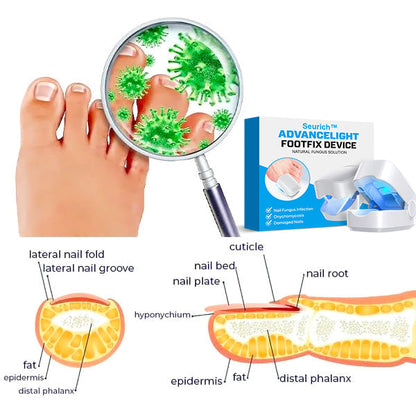 Seurich™ Pure Advance Light FootFix Device