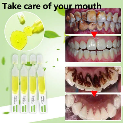 SmileMate™ Removal of tartar and plaque bacteria and various oral problems