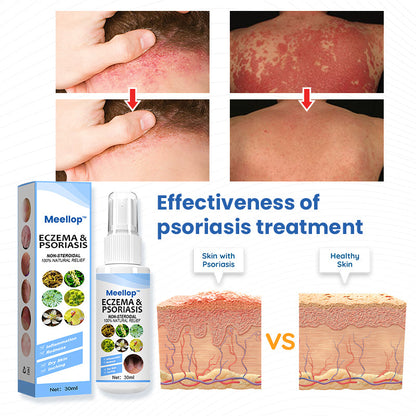 Meellop™ Herbal Psoriasis Relief Spray1