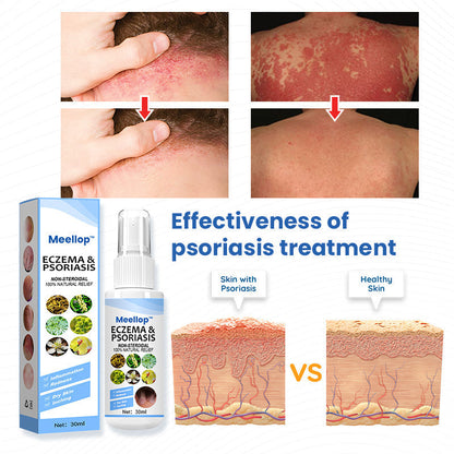 Meellop™ Psoriasis Treatment Spray💖