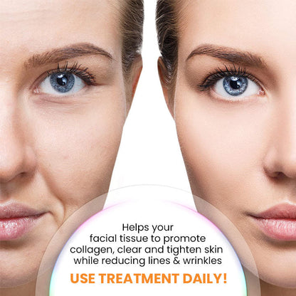 Oveallgo™ ProX Soluble Collagen Film from Korean Dermalayr Technology