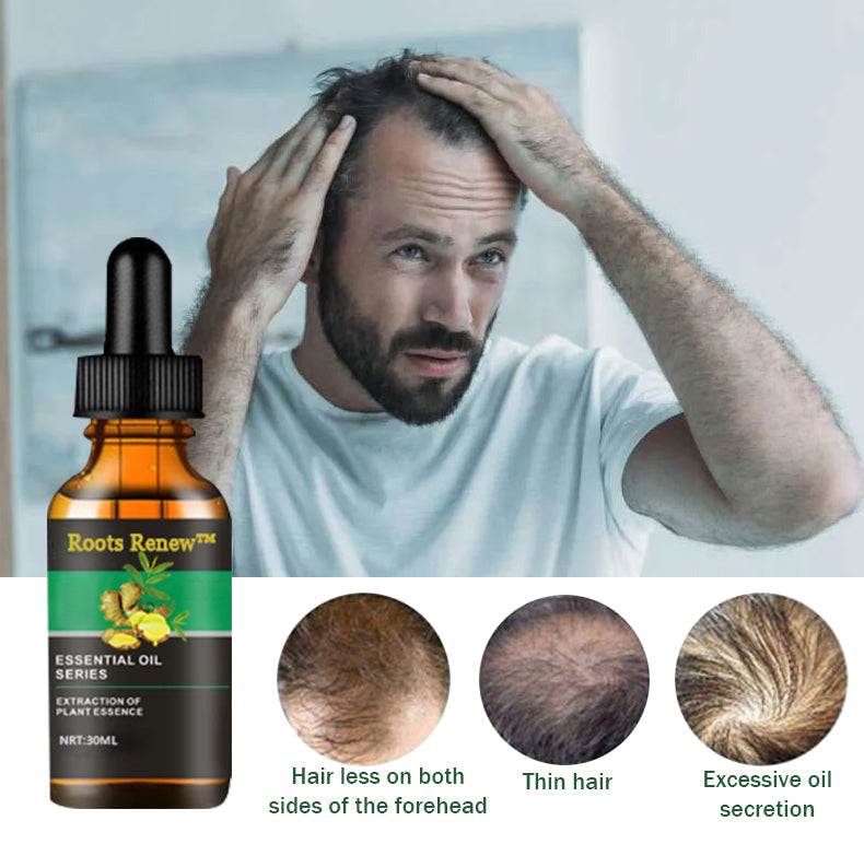 Roots Renew™ Ginger Hair Growth Serum  5% Minoxidil