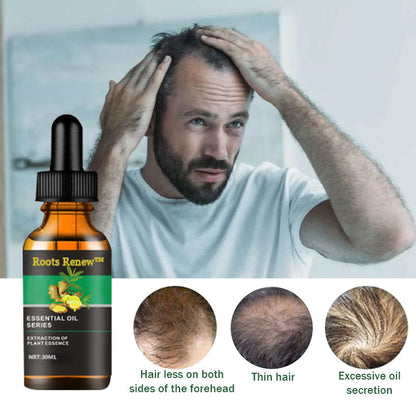 Roots Renew™ Ginger Hair Growth Serum  5% Minoxidil
