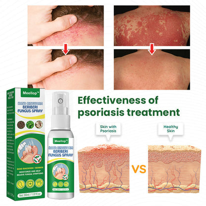 Meellop™ Herbal Psoriasis Relief Spray