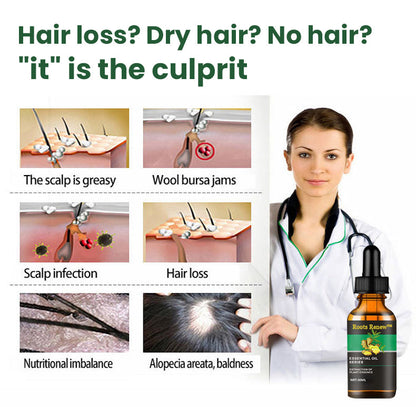 Roots Renew™ Ginger Hair Growth Serum  5% Minoxidil