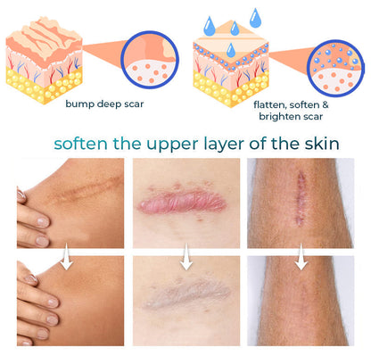 ASTA™ Advanced Scar Removal Gel 🔥