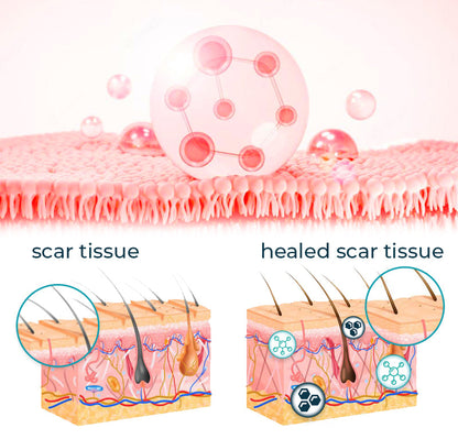 ASTA™ Advanced Scar Removal Gel 🔥